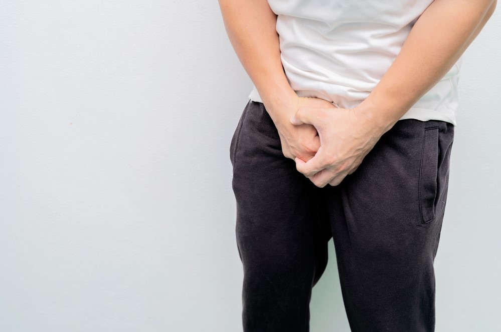 Have you noticed that you have a lump on your penis?  Many men feel certain changes in the sexual organ, but they do not know if it is something serious or commonplace.  Read in this text that this lump on the penis can be a problem known as Peyronie's Disease and what you can do to treat it.  Lump in the penis: what could it be?  Many men manifest a kind of lump in the penis at some point in their lives.  In some cases, they do not always realize when the problem has arisen, in fact, it is their partners or their partners who feel something different in the inner tissue.  However, not everyone pays attention to the issue.  Know that in any case it is necessary to seek medical help, because for whatever reason, lumps on the penis may need more serious treatments, because they can develop into conditions that will make sexual intercourse difficult or even trigger sexual impotence.  Now let's see what a lump in the penis can be: Peyronie's Disease In Peyronie's disease, an internal fibrosis in the sexual organ can look like a lump in the penis, which can be felt both at the time of erection and at rest from sexual activity.  This fibrosis is a repair tissue, which will lead to penile curvature, because scar plates are formed that modify the anatomy of the organ when erection occurs.  The most likely causes of these fibrosis are the microlesions that occur during the sexual act, but also during sleep, when the patient turns over on the erect penis.  Over time, these fissures will heal and become a plaque, which will bend the penis.  However, penile fractures, as discussed below, can also trigger Peyronie's disease.  The prevalence of Peyronie's disease varies from 3 to 9% of men, and the highest incidence is above 40 years of age.  The most common symptoms of Peyronie's disease are: Penile nodule - Peyronie's plaque: the patient reports that it feels like a lump in the penis; Pain in erection (initial phase); Acquired penile curvature: the patient reveals that the penis was straighter and curved out of nowhere; Thinning / indentations / acinturation of the penis; Decreased size of the penis; Erectile Dysfunction.  In general, Peyronie's disease is marked by two phases: acute and chronic.  In the first, the man may feel pain during erection or penetration, when the lump is already perceived in the erect penis, because an inflammatory procedure has been triggered from the fissures.  He will also notice that your penis is bent, different from its original anatomy.  In the chronic phase, when these fissures have already formed the scar plate, which is sedimented, if the patient is not careful, he may have curvatures so intense that they prevent sexual penetration, it may be dorsal, ventral or lateral curvature, or the penis too may have an hourglass shape when erect.  Penis Fractures Although the penis is boneless, it can suffer a fracture, which most often occurs during more vigorous intercourse or intense masturbation, when the penis is filled with blood and stiffened.  However, penile fracture can also occur during a sports practice or even a vehicle accident.  It is a case of medical emergency, because it hurts a lot and needs surgery to fix the fracture within 24 hours and even if this deadline is exceeded, operating is the best solution.  The purpose of surgery is to restore erectile function earlier and avoid sequelae such as penile curvatures, deformities and fibrosis.  When the patient does not seek this medical help, the tear suffered in the tunica albuginea of ​​the penis will heal on its own, but it may cause a lump to appear on the penis, which will also lead to Peyronie's disease or other sequelae such as erectile dysfunction.  What can be done to treat?  In this acute phase, treatments aim to oxygenate the penis, improving circulation.  At this early stage, changing lifestyle habits will also help, such as quitting smoking, having a better diet and practicing physical activities can help.  For those cases in which the lump on the penis has evolved into the acquired curvature, but is not yet above 30 degrees, treatment in the acute phase may involve traction devices, medications, and shock wave therapy.  In addition, the doctor may also indicate that the patient takes more care to prevent new fissures in the penis, such as taking care with the vigor of masturbation and even avoiding certain sexual positions that favor the escape of the penis, in addition to not forcing penetration when the organ is not fully erect.  In the chronic phase, which can be considered from 6 months to 1 year after the beginning of the inflammatory process, when the curvature is already settled, the best approach will be penile correction surgery, to reconstruct the shape of the penis.  In some cases, the sexual dysfunction triggered by Peyronie's disease is so severe that, in addition to corrective surgery, penile prosthesis implantation is also necessary to restore the patient's satisfactory sex life.  Doctor's Word Men need to develop awareness of taking care of their health, not only to treat existing pathologies, but also to avoid certain problems, including sexual ones.  Taking care of sexual health is extremely beneficial, because sex is synonymous with life!  Men who take care of the vascularization of the penis through healthy habits tend to live longer and with better quality.  It is ideal to go through consultations with a urologist or andrologist in a preventive way to get to know your own body and avoid certain male health problems of a sexual nature. 