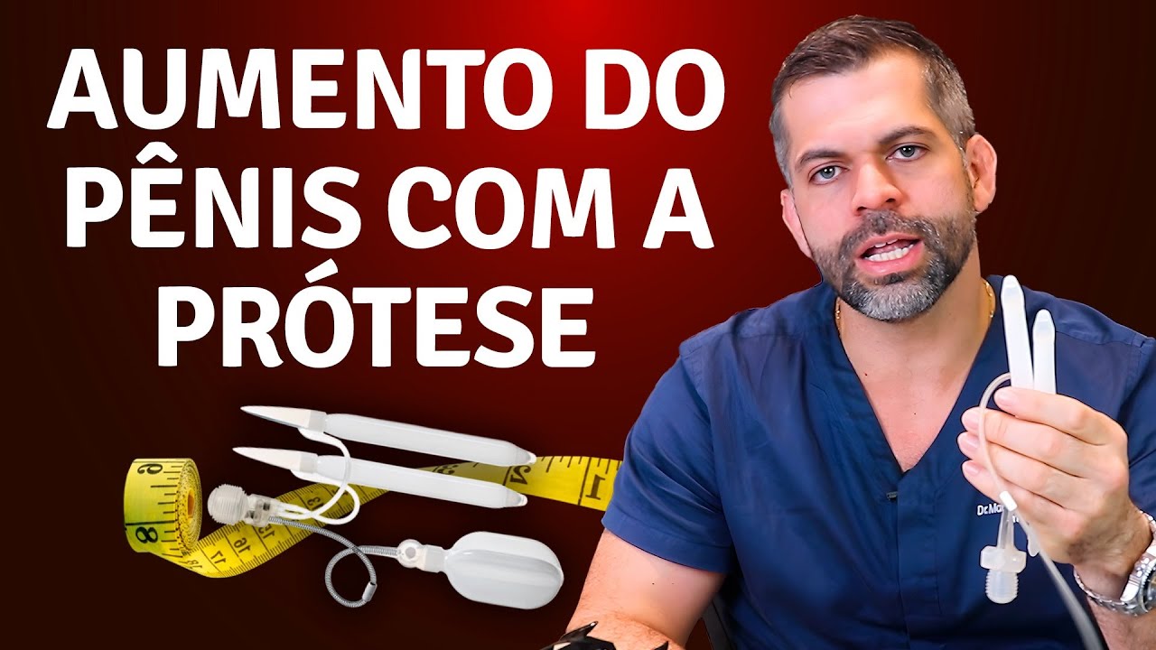 Canal do Dr. Marco Túlio Cavalcanti Aumento do pênis com a prótese peniana | Dr. Marco Túlio Cavalcanti – Andrologista e Urologista