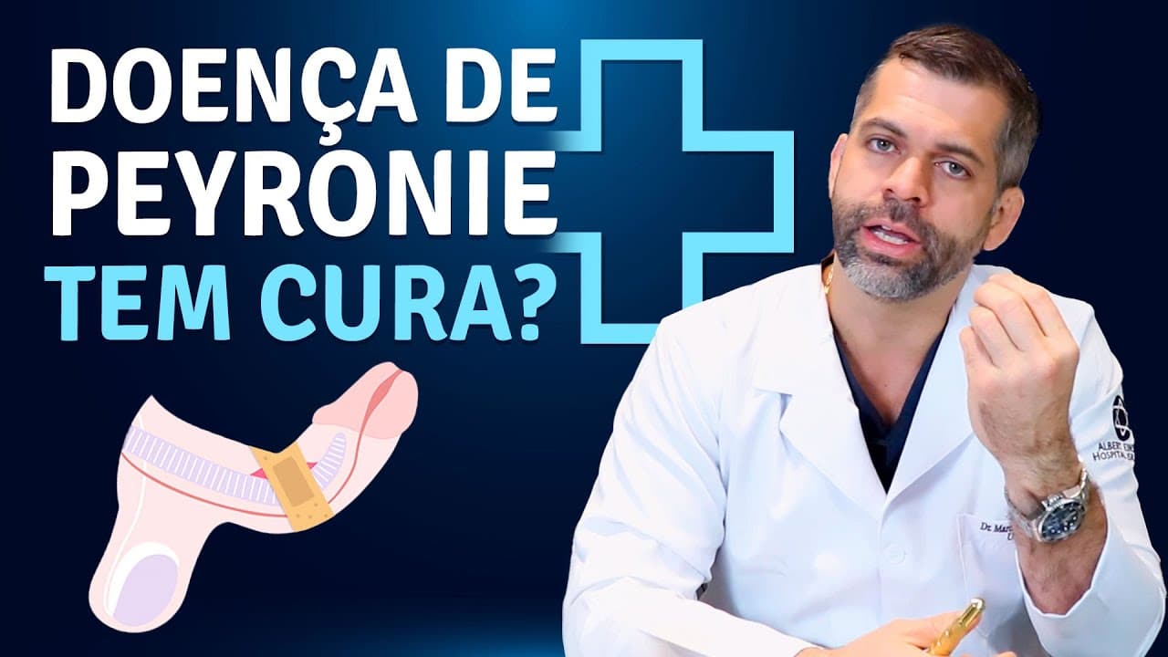 Canal do Dr. Marco Túlio Cavalcanti Doença de Peyronie Tem Cura? | Dr. Marco Túlio Cavalcanti – Andrologista e Urologista